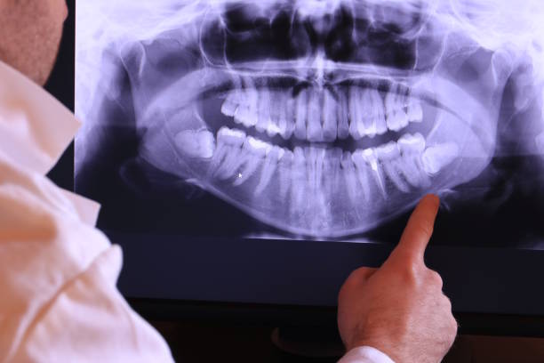 Best Emergency Dental Care for Broken or Chipped Teeth in Manor, PA