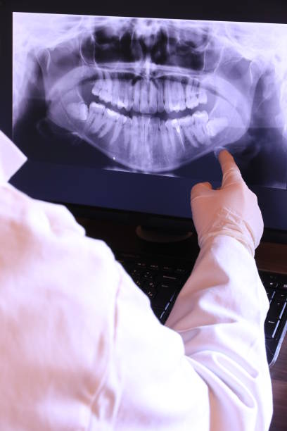 Best Emergency Treatment for Dental Infections or Abscesses in Manor, PA